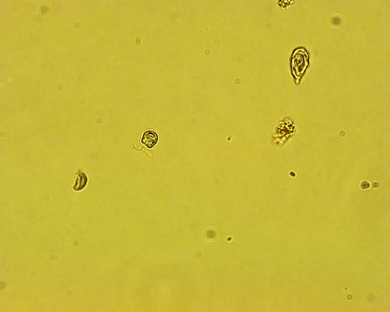 Dictyocha speculum